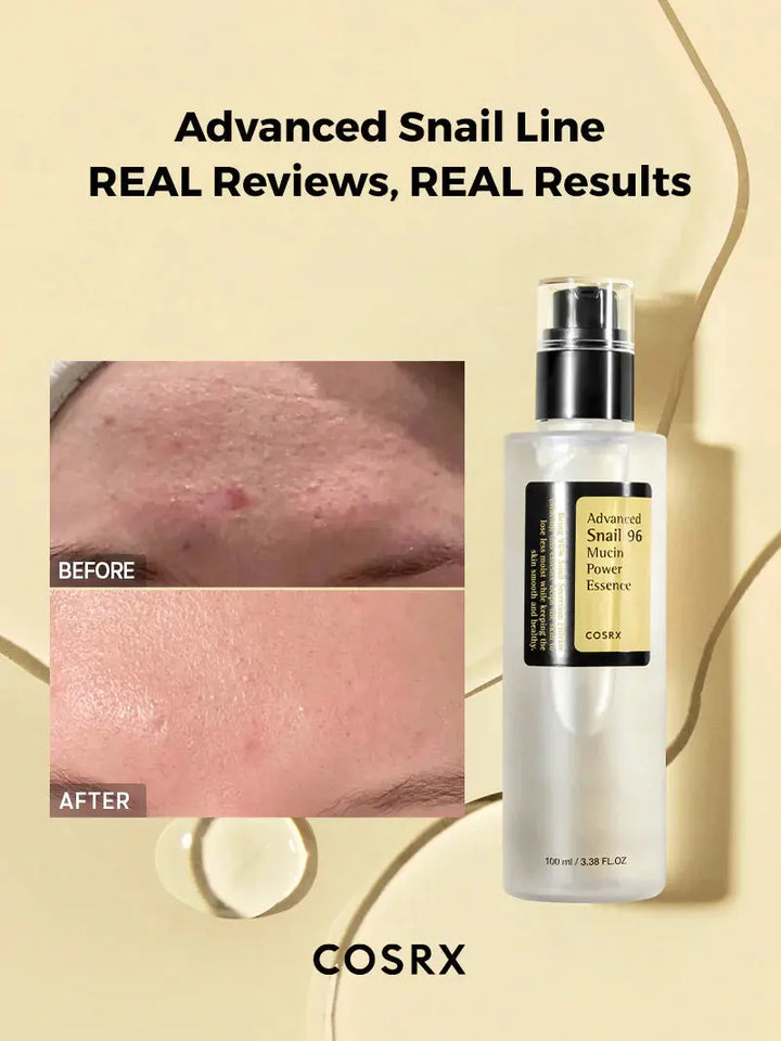 COSRX Advanced Snail 96 Mucin Power Essence esencija, 100 ml COSRX